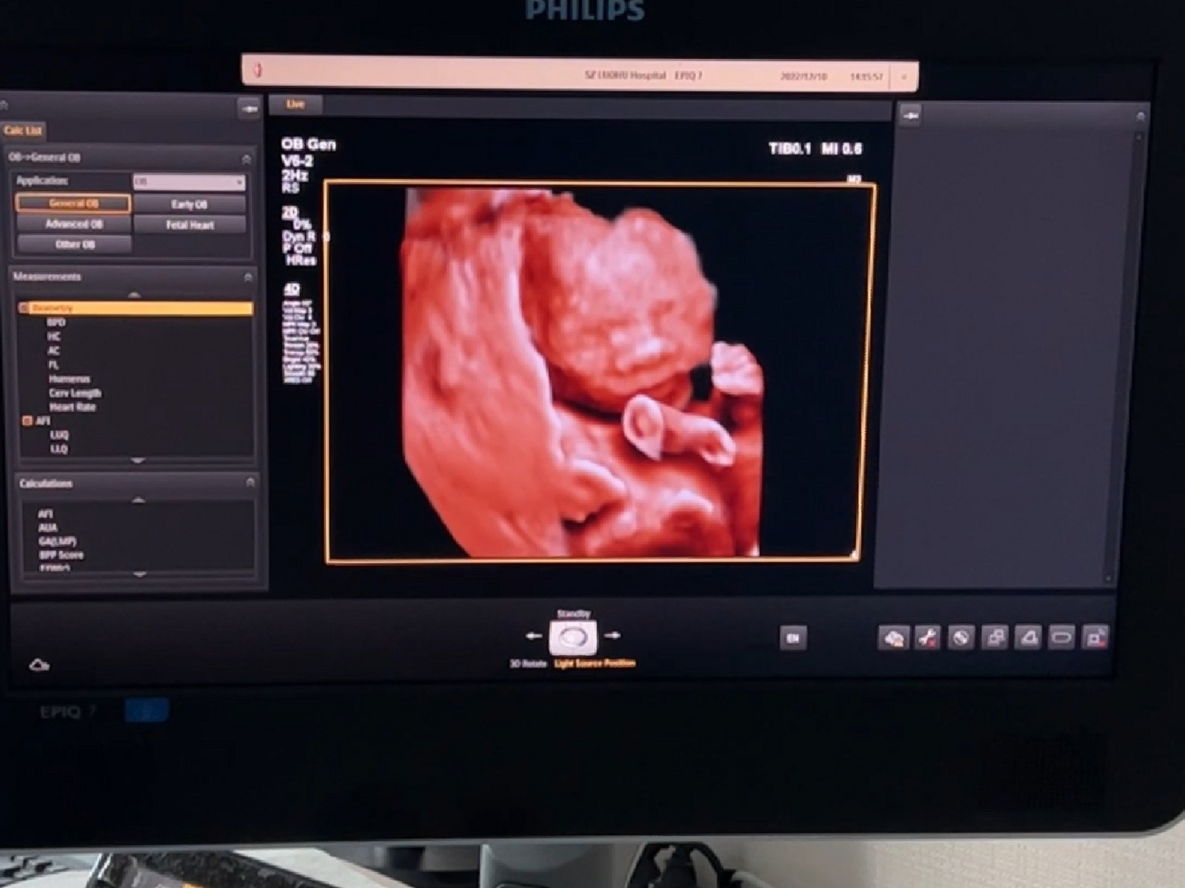 02孕22周,四维顺利通过 约的周六下午两点,所以差不多吃完午饭就