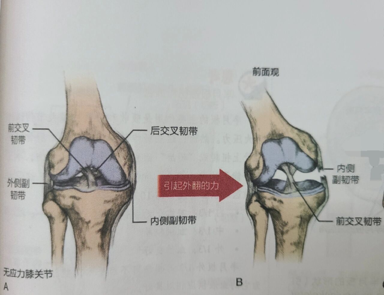 认识内侧副韧带 7815内侧副韧带