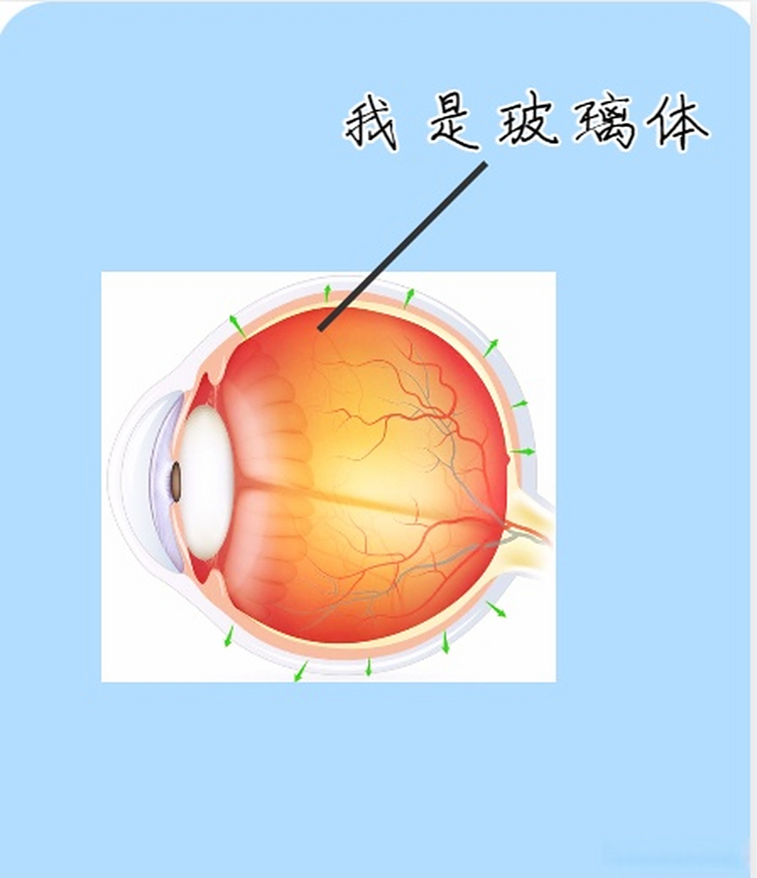 增殖性玻璃体视网膜病变  如果你也有玻璃体问题评论区可以回复以上