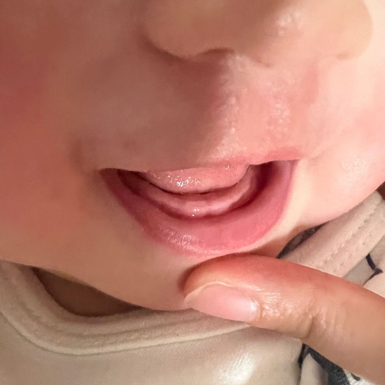 6个半月长牙了07 这几天发现她牙龈红肿,冒白的,还爱吃手,什么都往