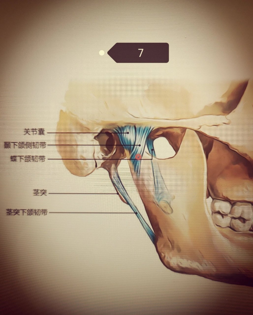 颞下颌关节解剖及其功能分析 颞下颌关节解剖及其功能分析 学点康复