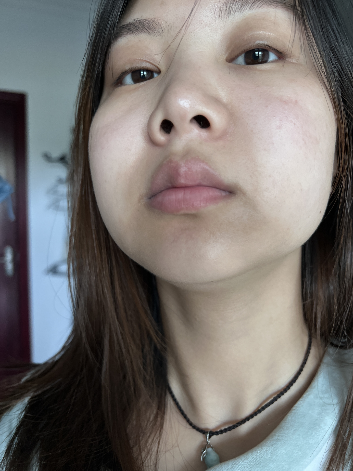 嘴巴周围的暗沉怎么可以去掉 好像从小就是发黄不均匀 也有中医说是