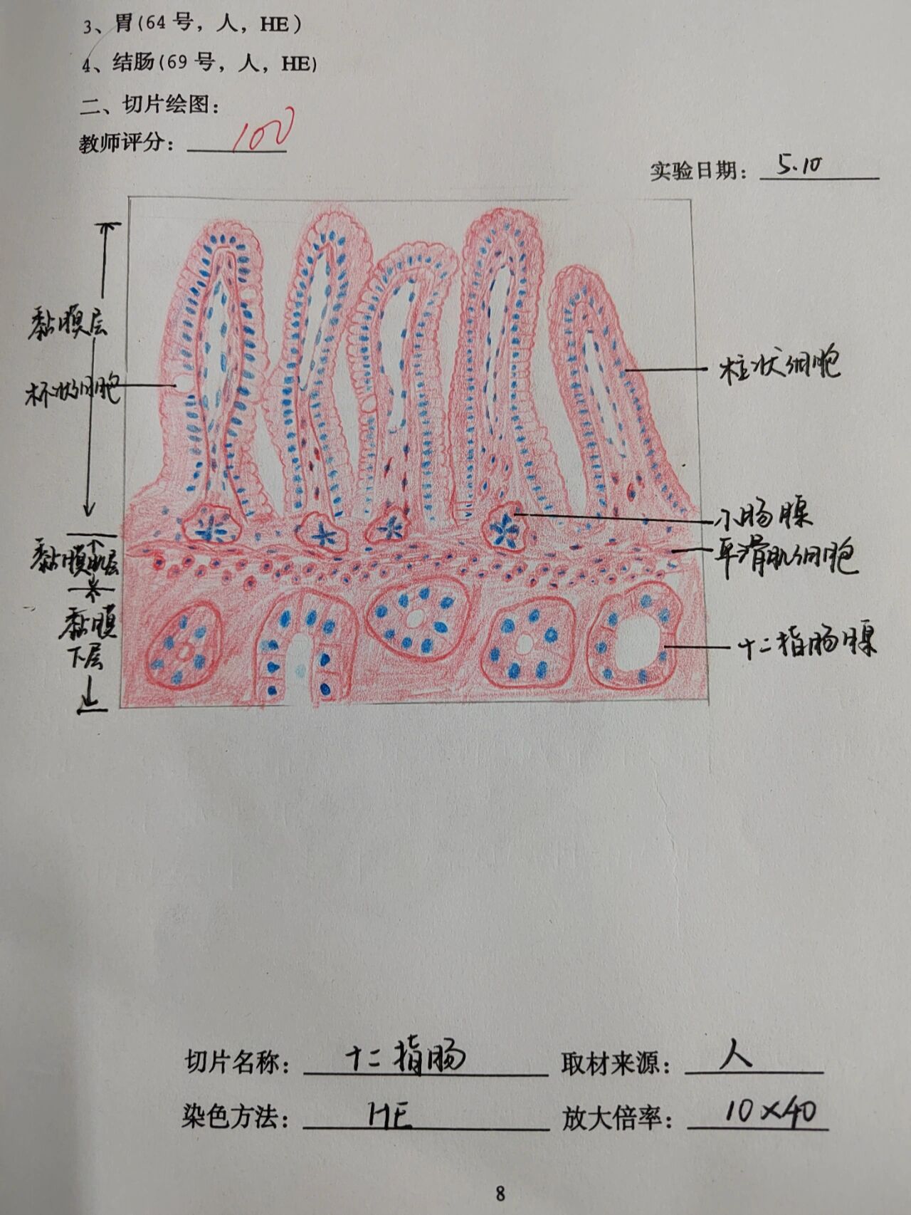 甲状腺红蓝铅笔绘图图片