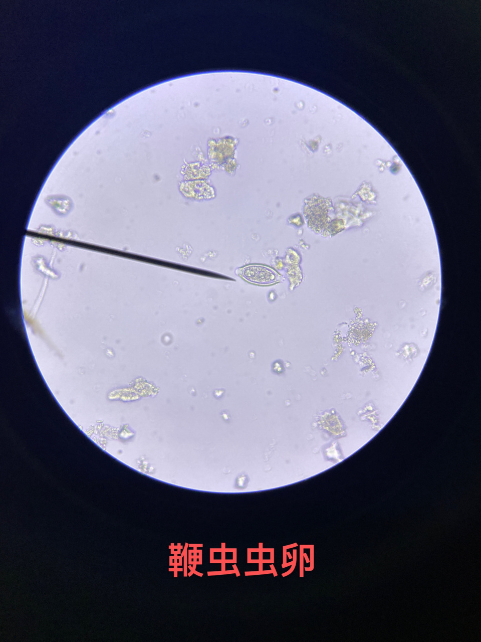 虱子卵显微镜图片大全图片