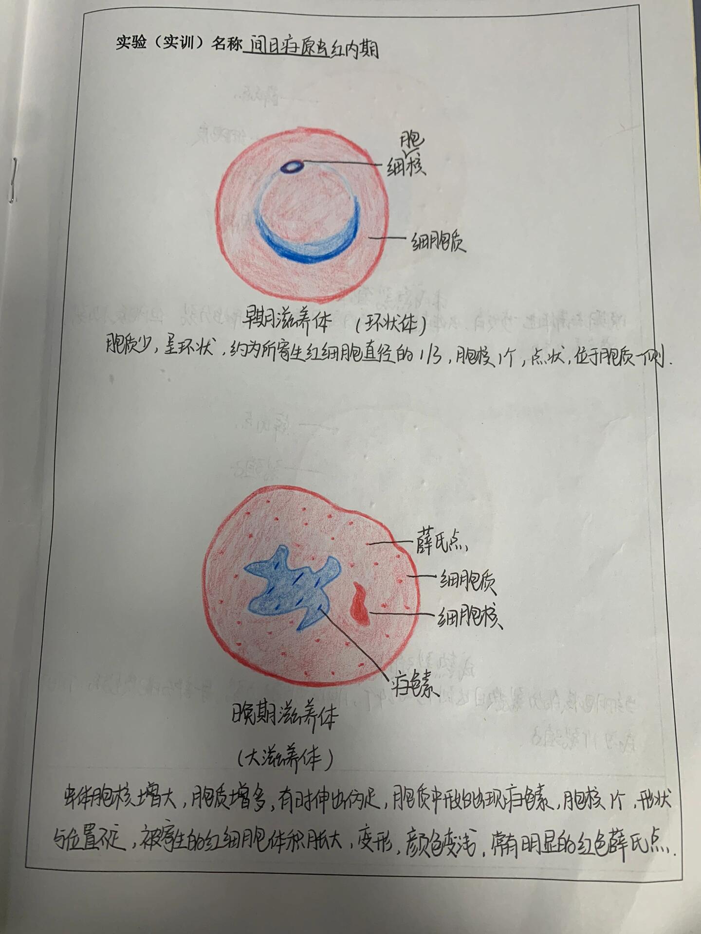 间日疟原虫红内期图片