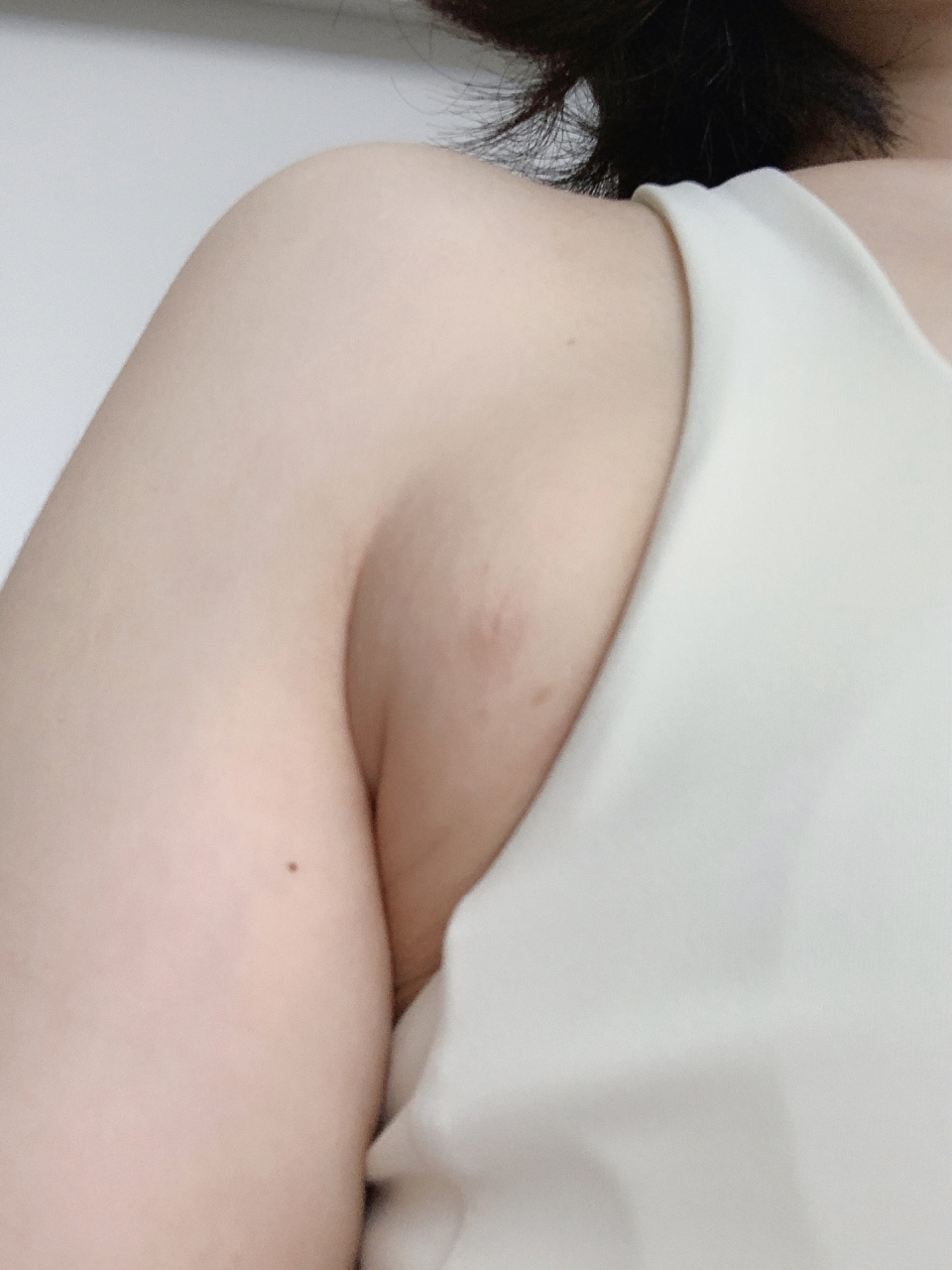 给你们看看什么是真正的副乳 请不要再说自己有副乳了,你们那只是腋下