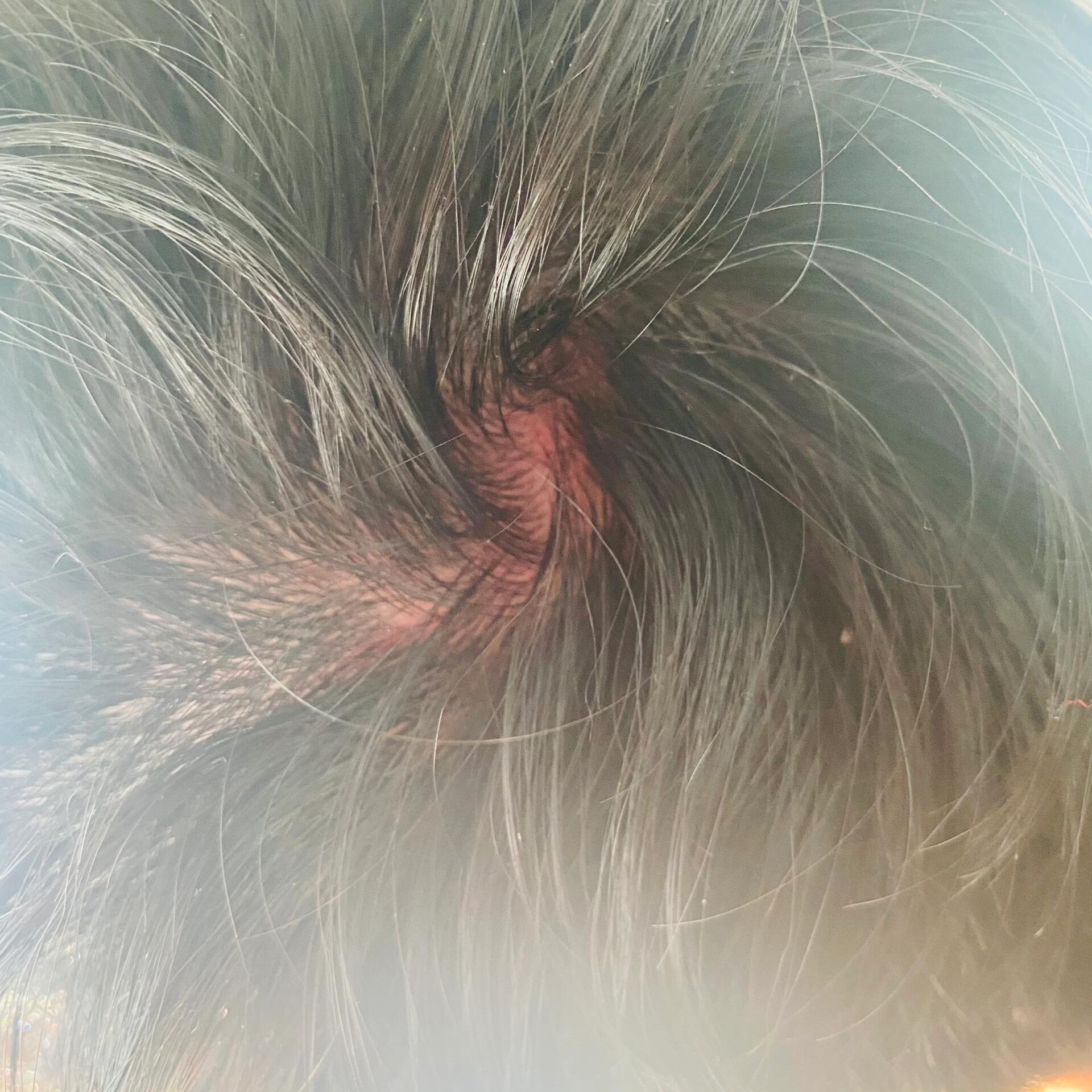 头发被薅了 打架头发被薅了要怎么办啊