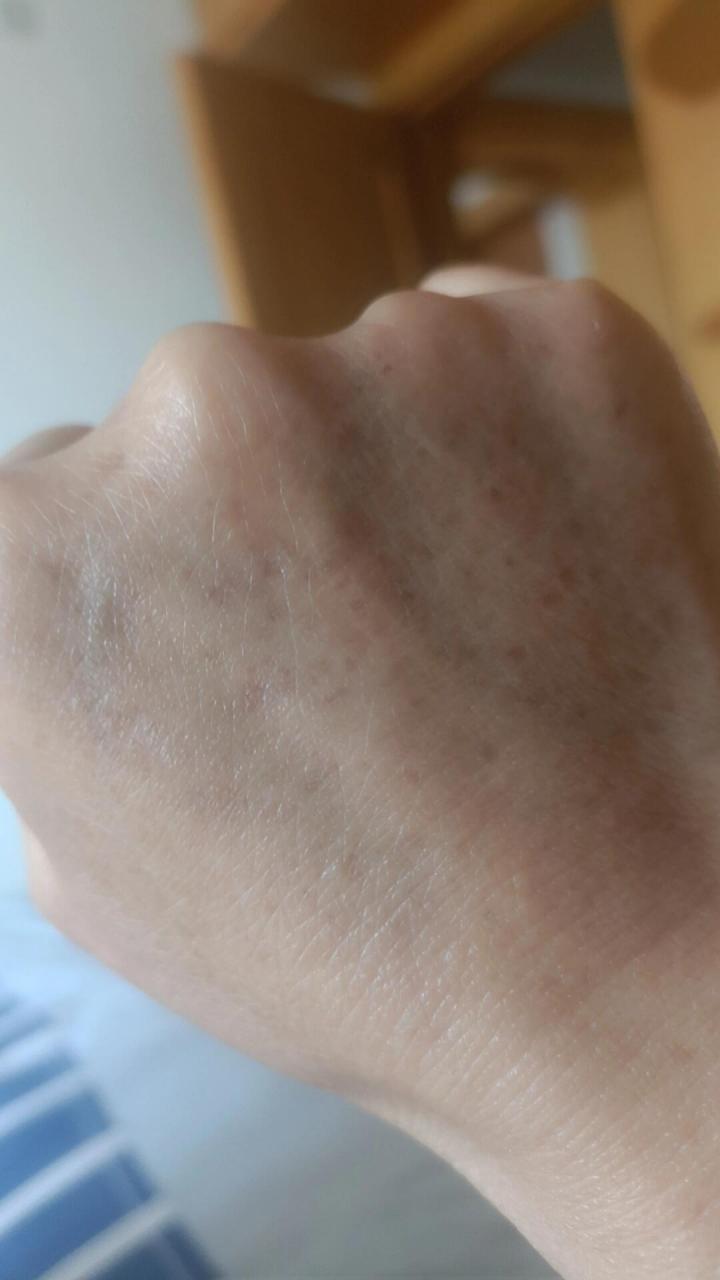 手上这是老年斑吗?