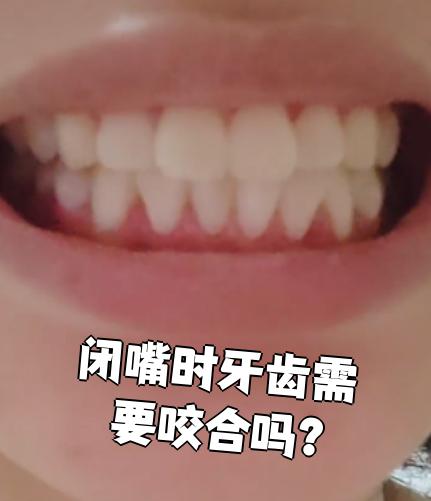 正常情况下,嘴唇闭合时牙齿处于放松状态,上下牙之间会留有2~3毫米