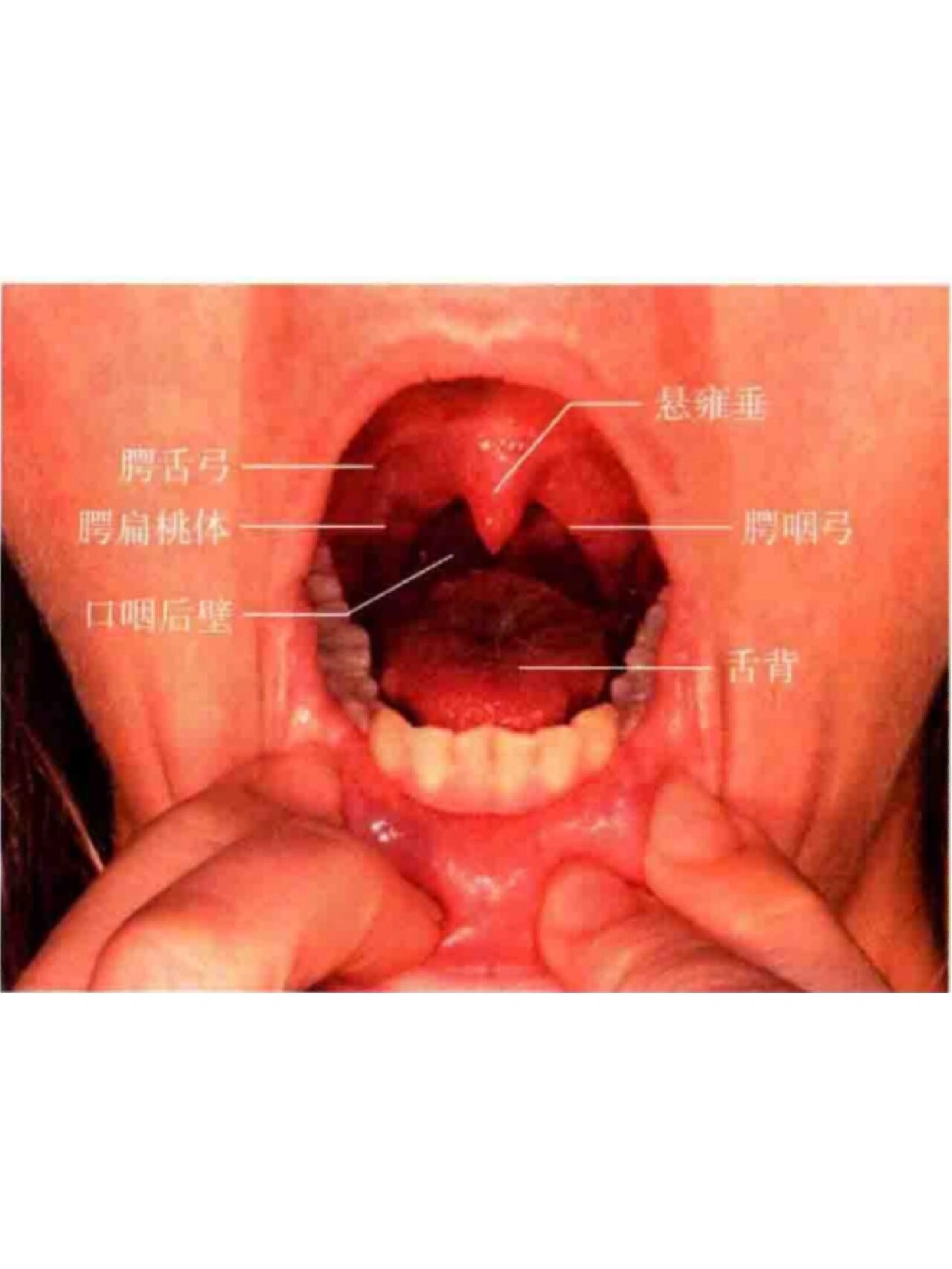 咽期,食管期三个分期 口腔期的组成: 1,软组织部分:唇,颊黏膜,软腭