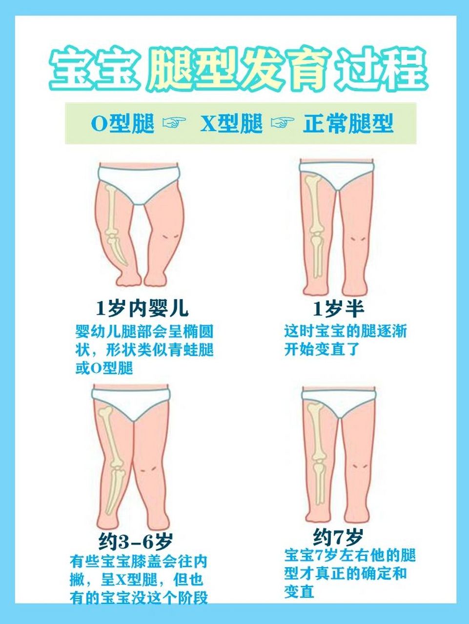 8215新生儿-1岁半: o型腿 82151岁半-2岁:正常腿型 8215