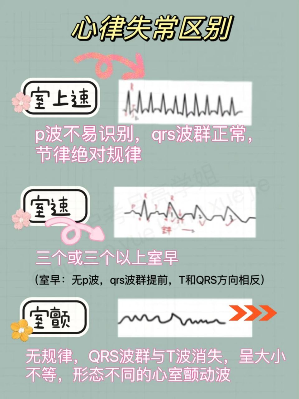 73护考笔记室速vs室上速 有朋友分不清楚室速,室上速,今天分享一下.