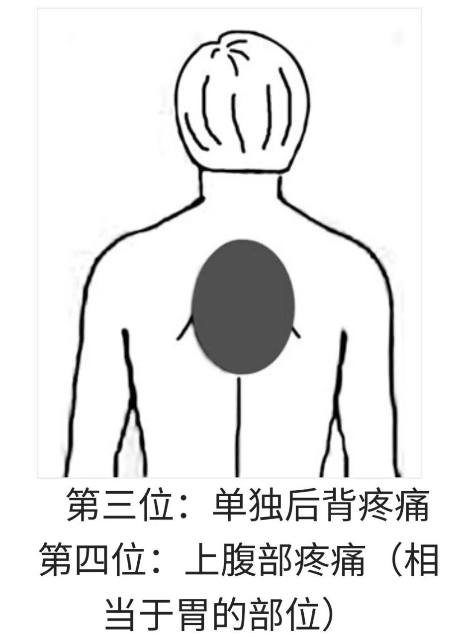 心肌梗塞是哪里痛图片图片