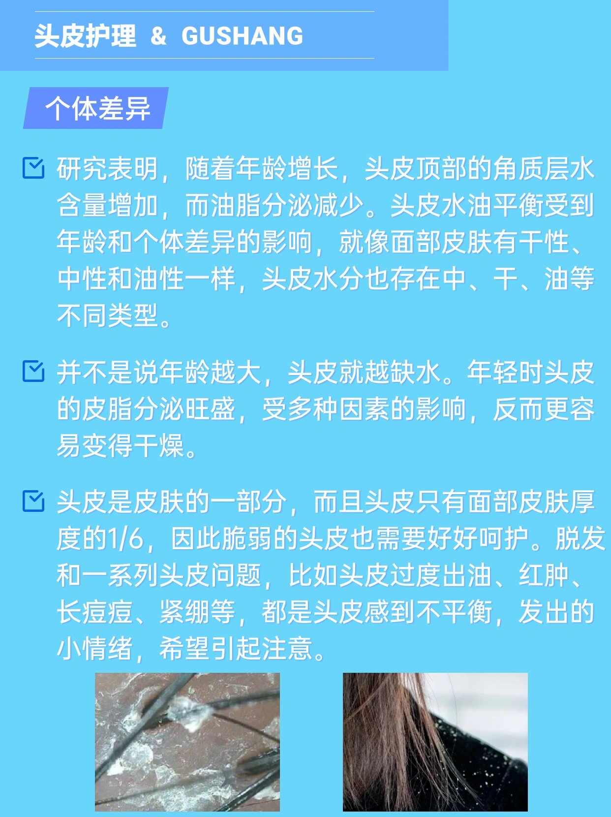 洗头也经常暴力洗头,结果就是导致头皮又干又起头屑,头发也是干枯的