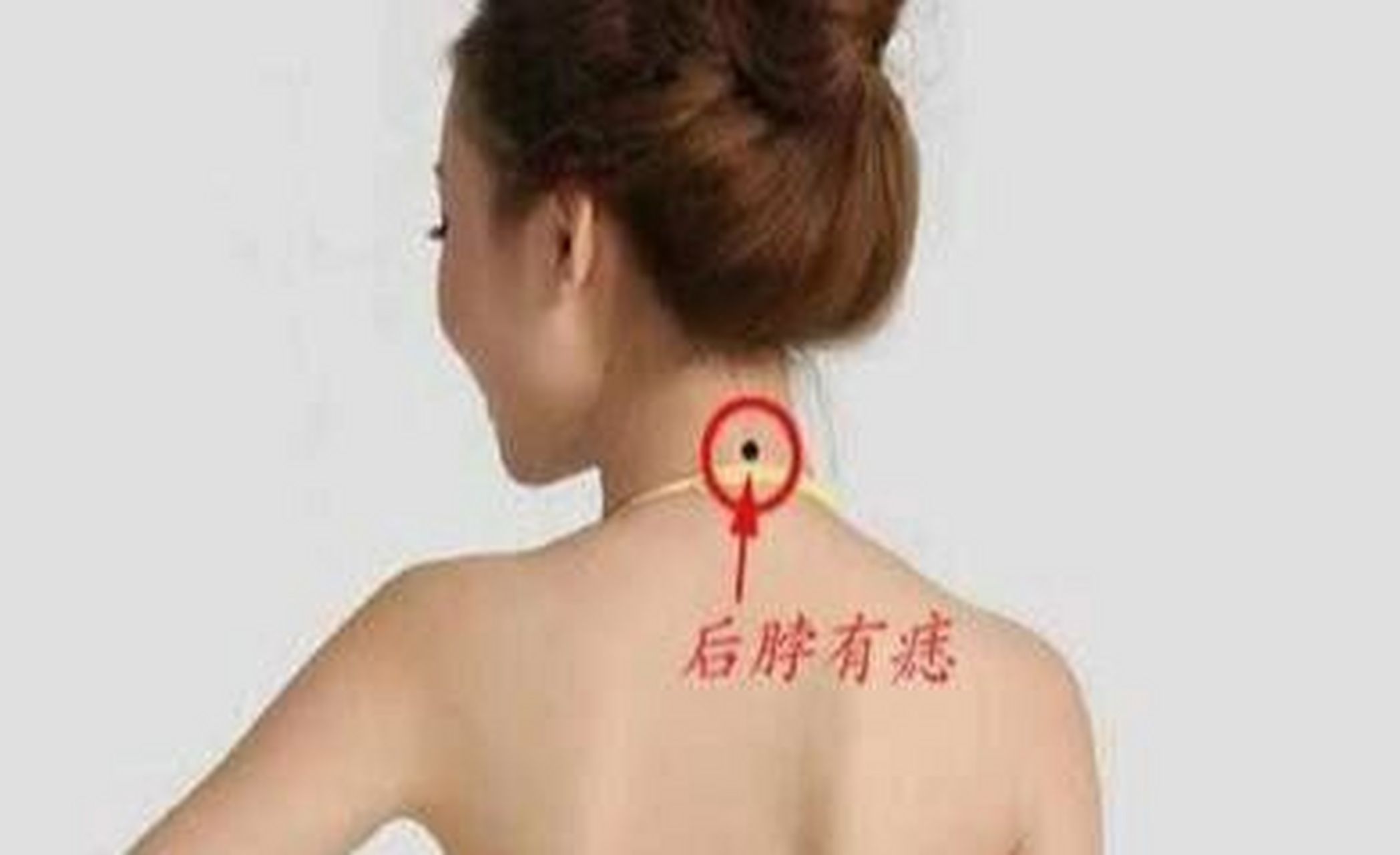 脖子后的痣寓意好坏皆有,好的一方面,脖子后的痣也是背有靠山的寓意