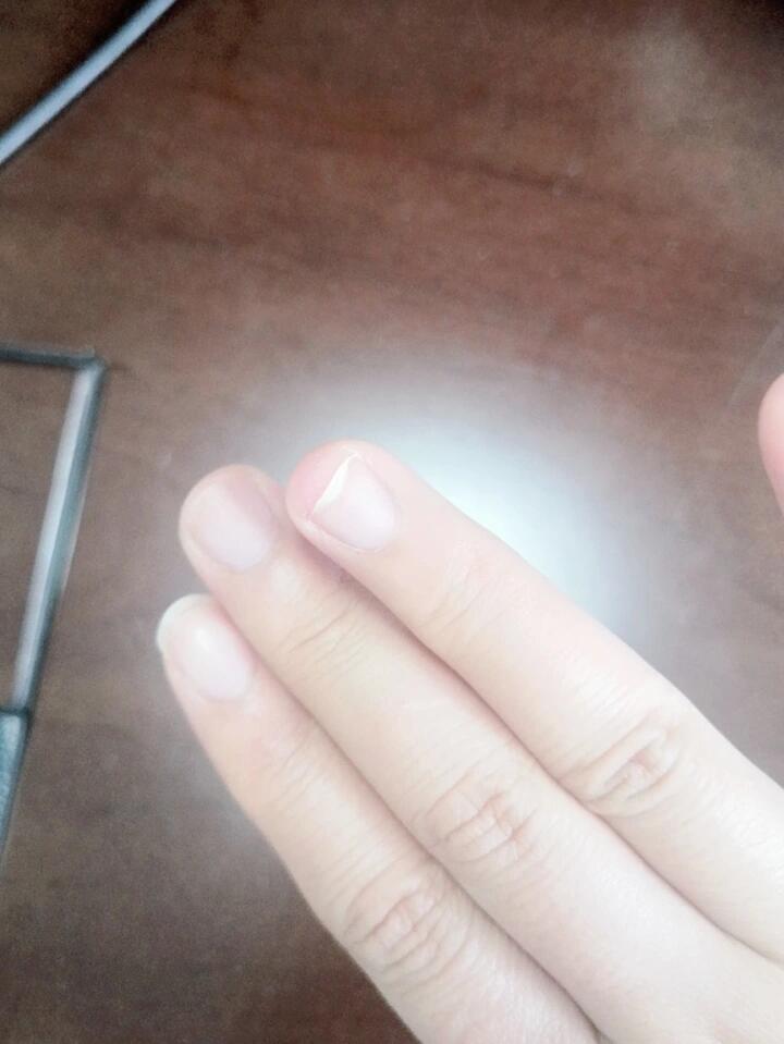 指甲有一截空的,跟肉不粘着,有什么方法可以拯救一下吗?