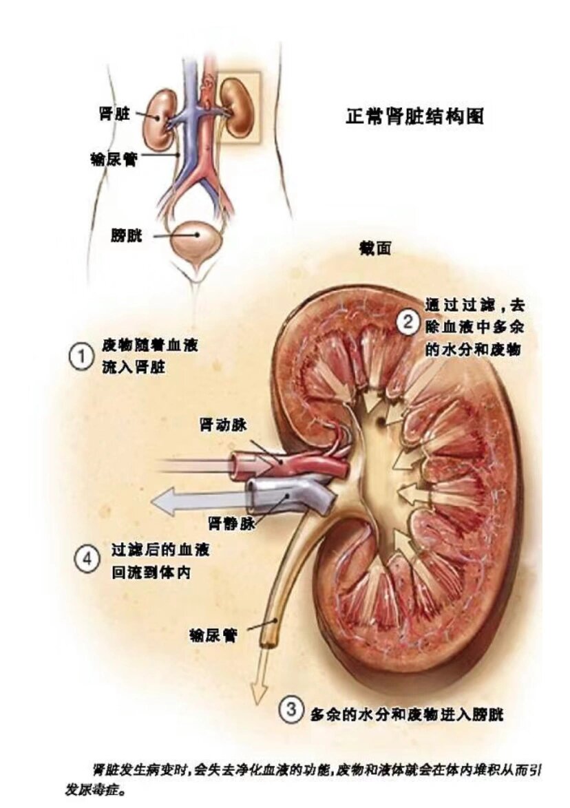 慢性肾衰的定义: 慢性肾功能衰竭是在发生各种慢性肾脏疾病基础上