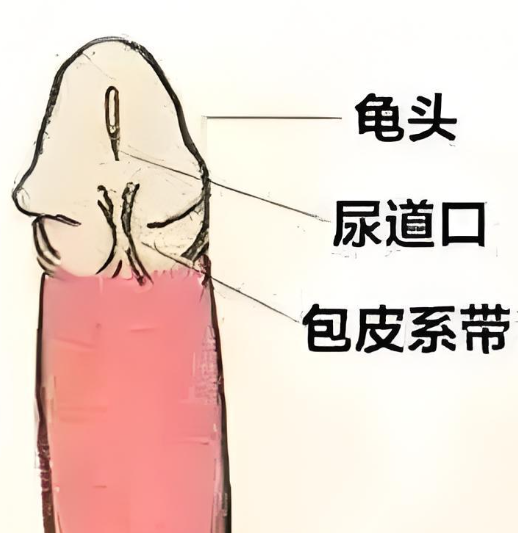 男生系带过短需要做系带延长术