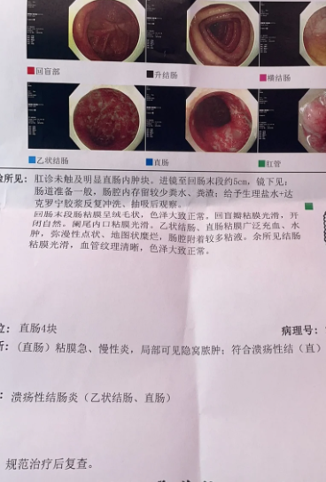 肠炎宁片饭前或饭后吃都可以