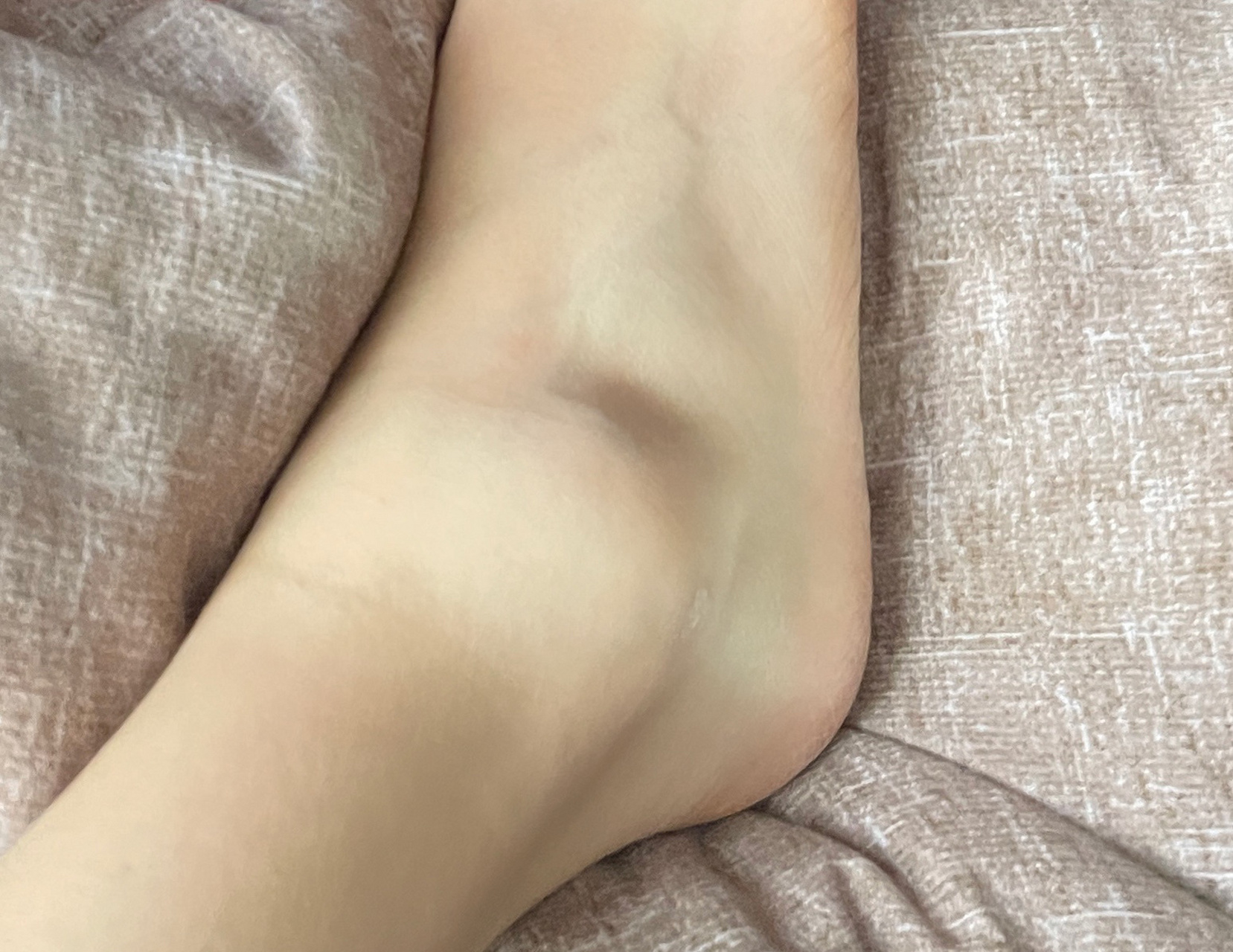 崴脚脚踝骨折多久能下地呢?