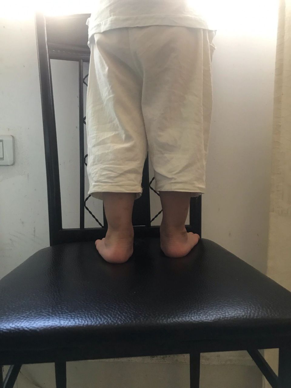 宝宝的脚内翻 刚刚满2岁 脚有的翻 要紧吗