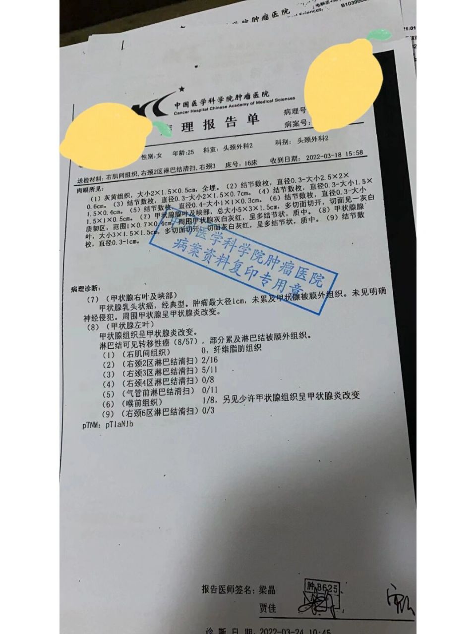 东肿|鄢丹桂医生|甲状腺全切右颈清 本来是有桥本,正好去年11月份该到