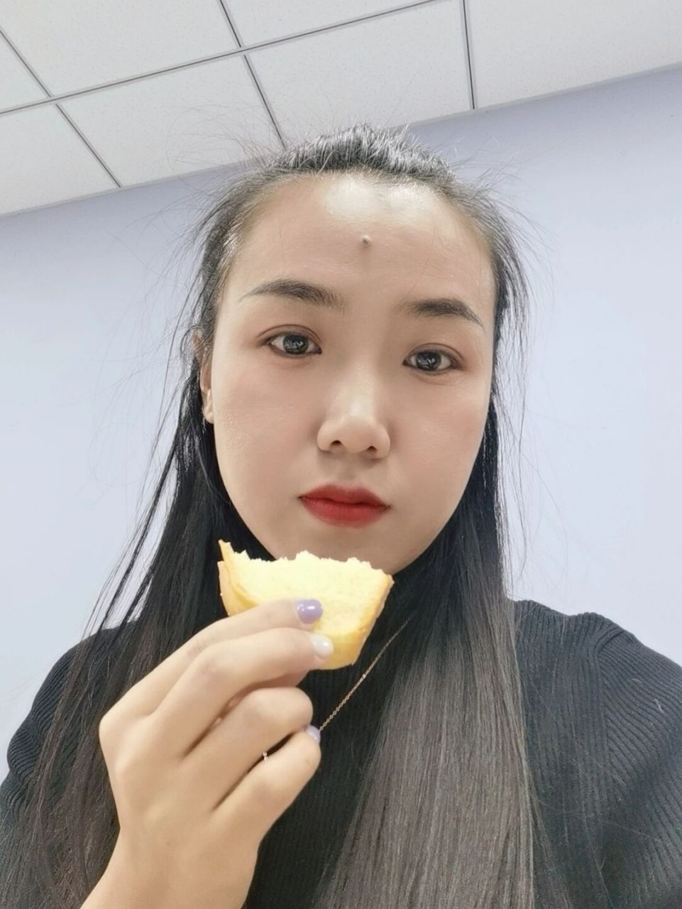 额头的痣要不要去掉呢 上小学时,额头上就长出了这个痣,有人说这是好