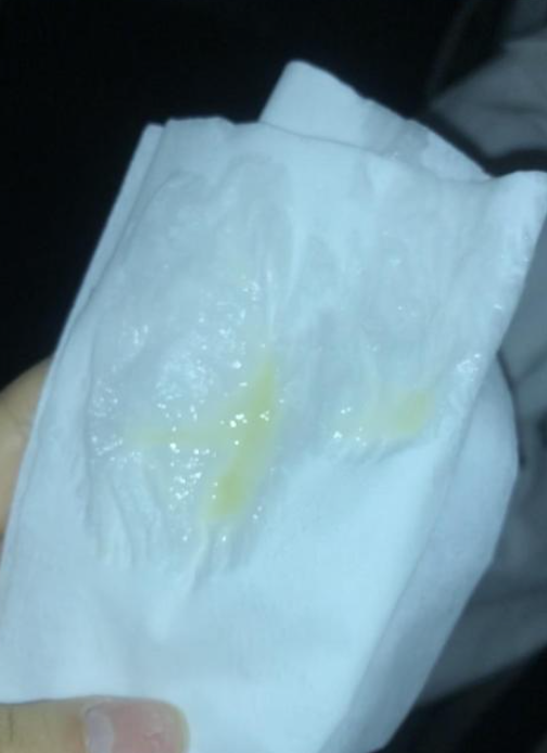 正常内裤上的分泌物主要是白带