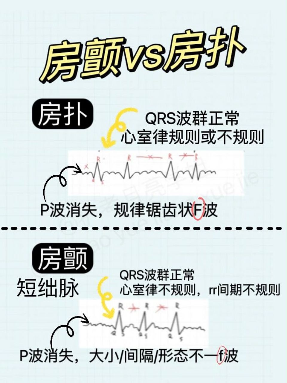 室颤和房颤图片