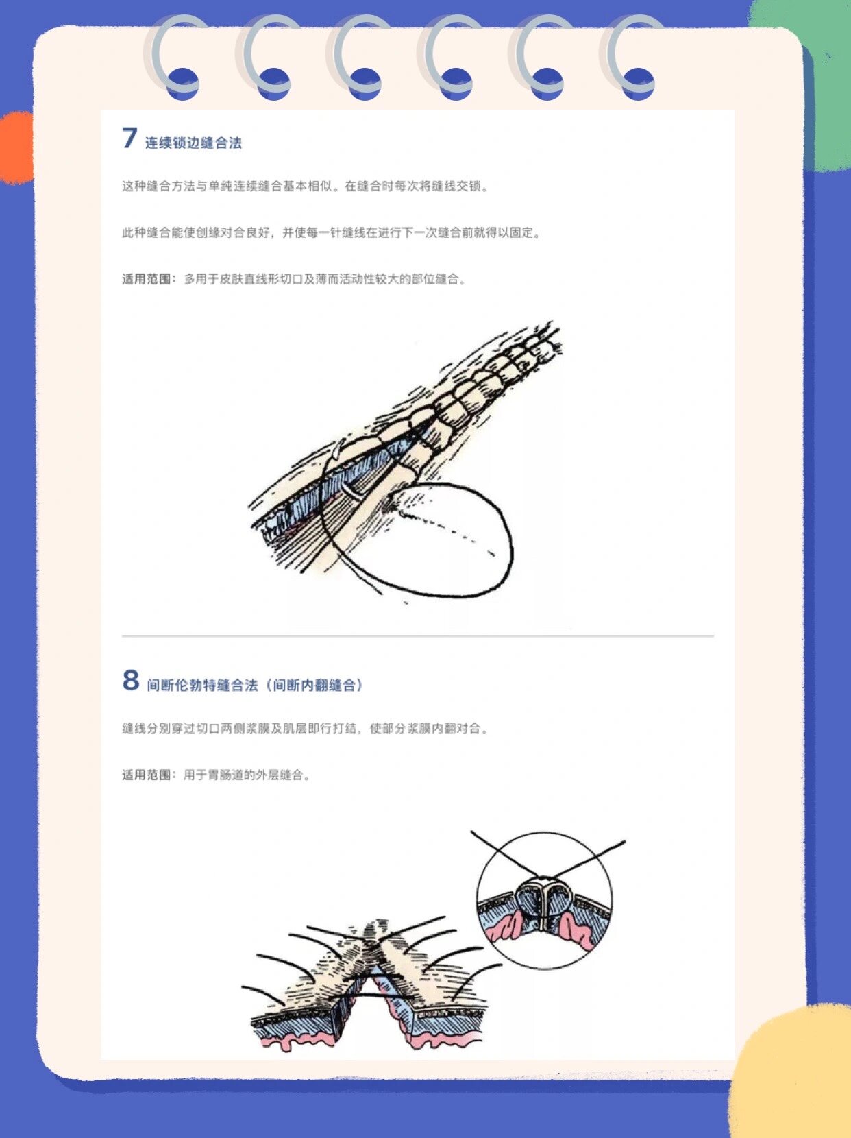 13种外科缝合方法 1 单纯间断缝合(结节缝合) 适用范围:结节缝合