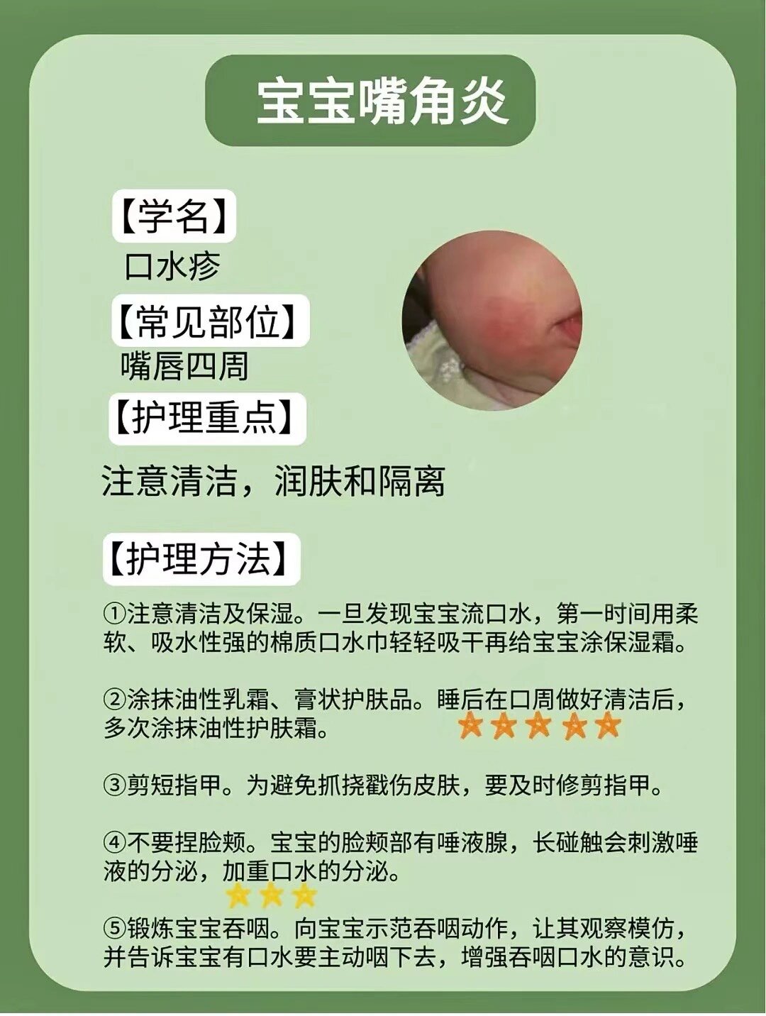 痱子和湿疹区分7171宝宝皮肤问题看过来7373    宝宝皮肤问题
