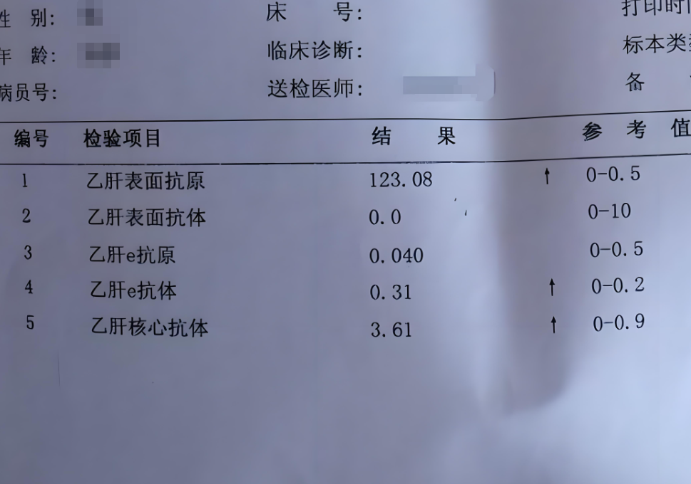 乙肝五项第五项阳性就是乙肝核心抗体阳性