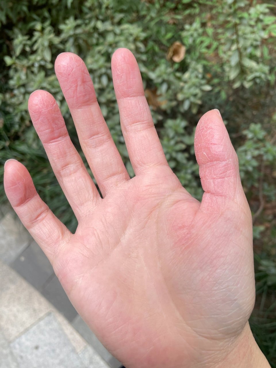 换季掉皮,开裂,每次开口都痛的不行,看似这手是干的不行,可偏偏又爱