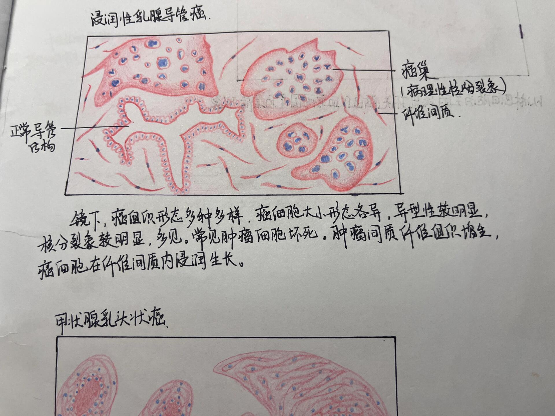 乳腺癌红蓝铅笔绘图图片