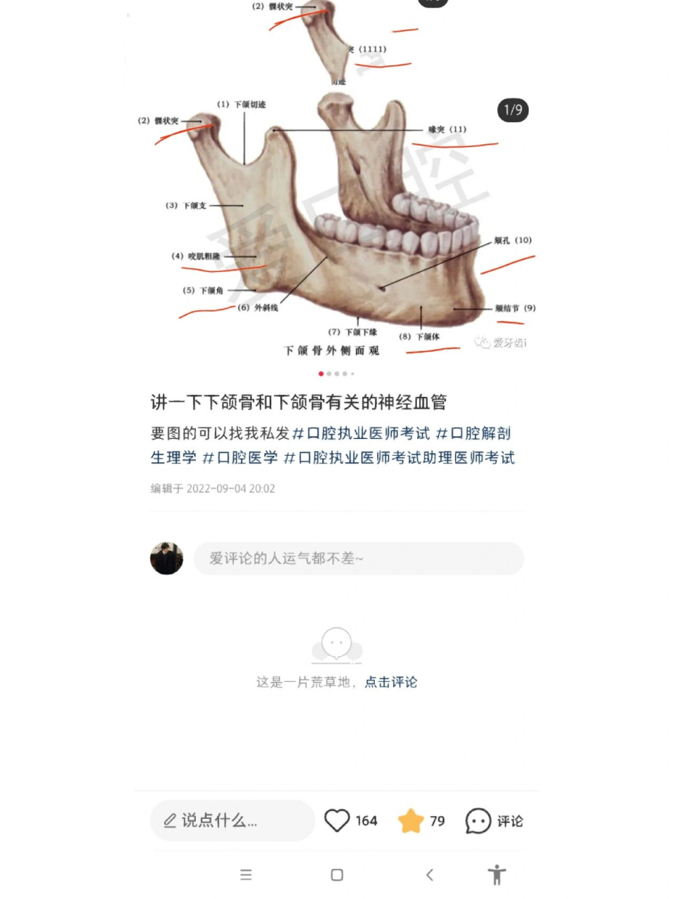 髁状突位置图片