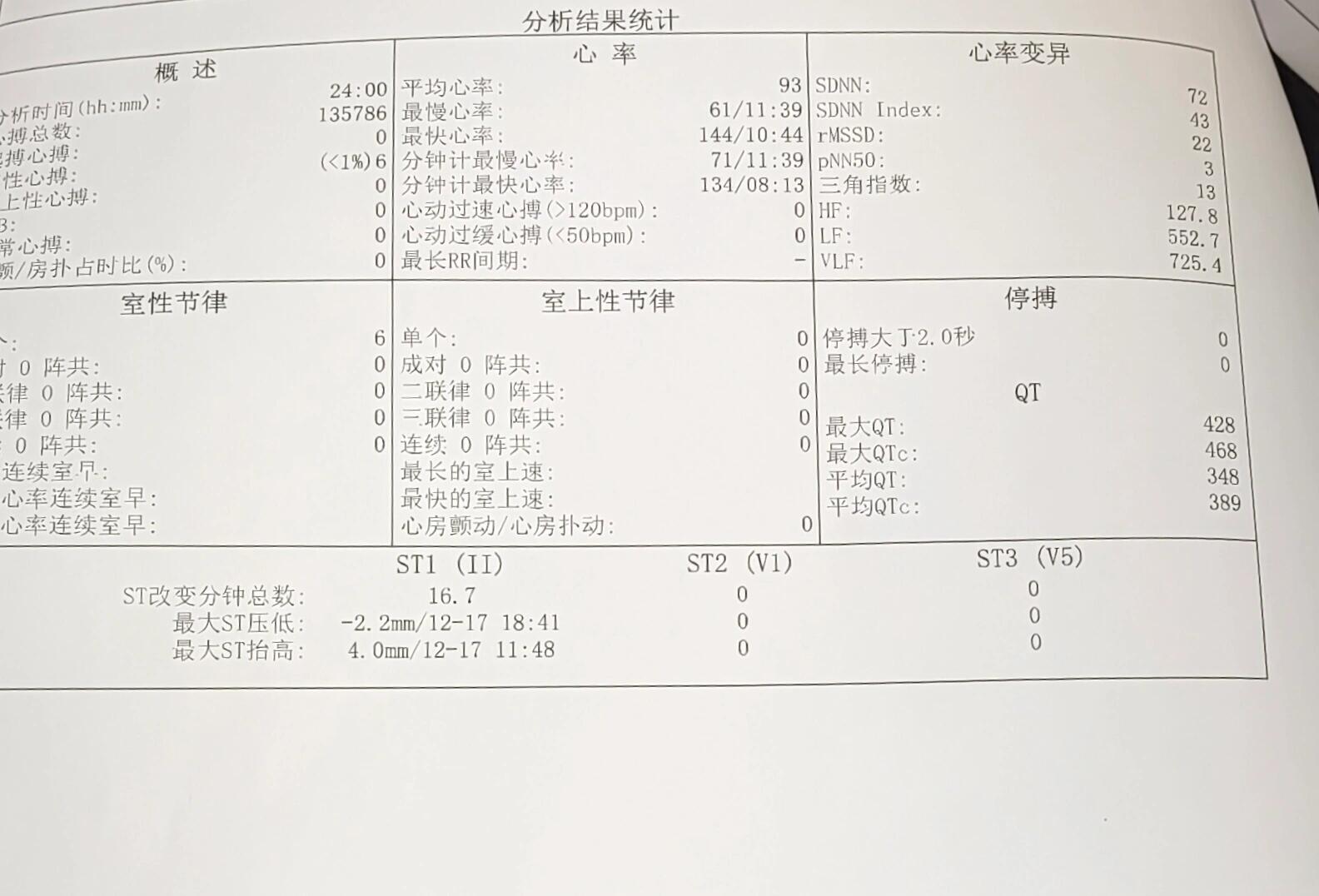 这个心电图有什么问题? st段抬高和压低说明什么?