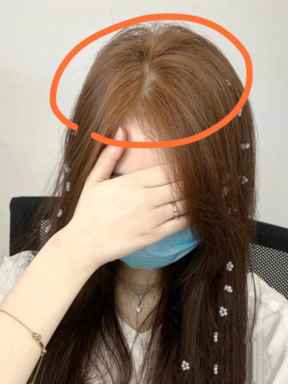 为什么染完头发头顶会发黄 发亮 相信很多人都会有染完头发爆顶的经历