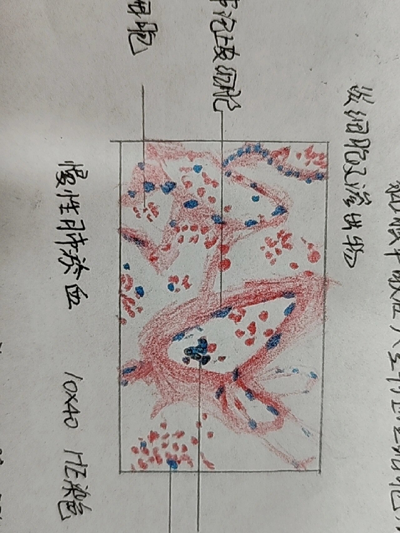 肺淤血绘图图片