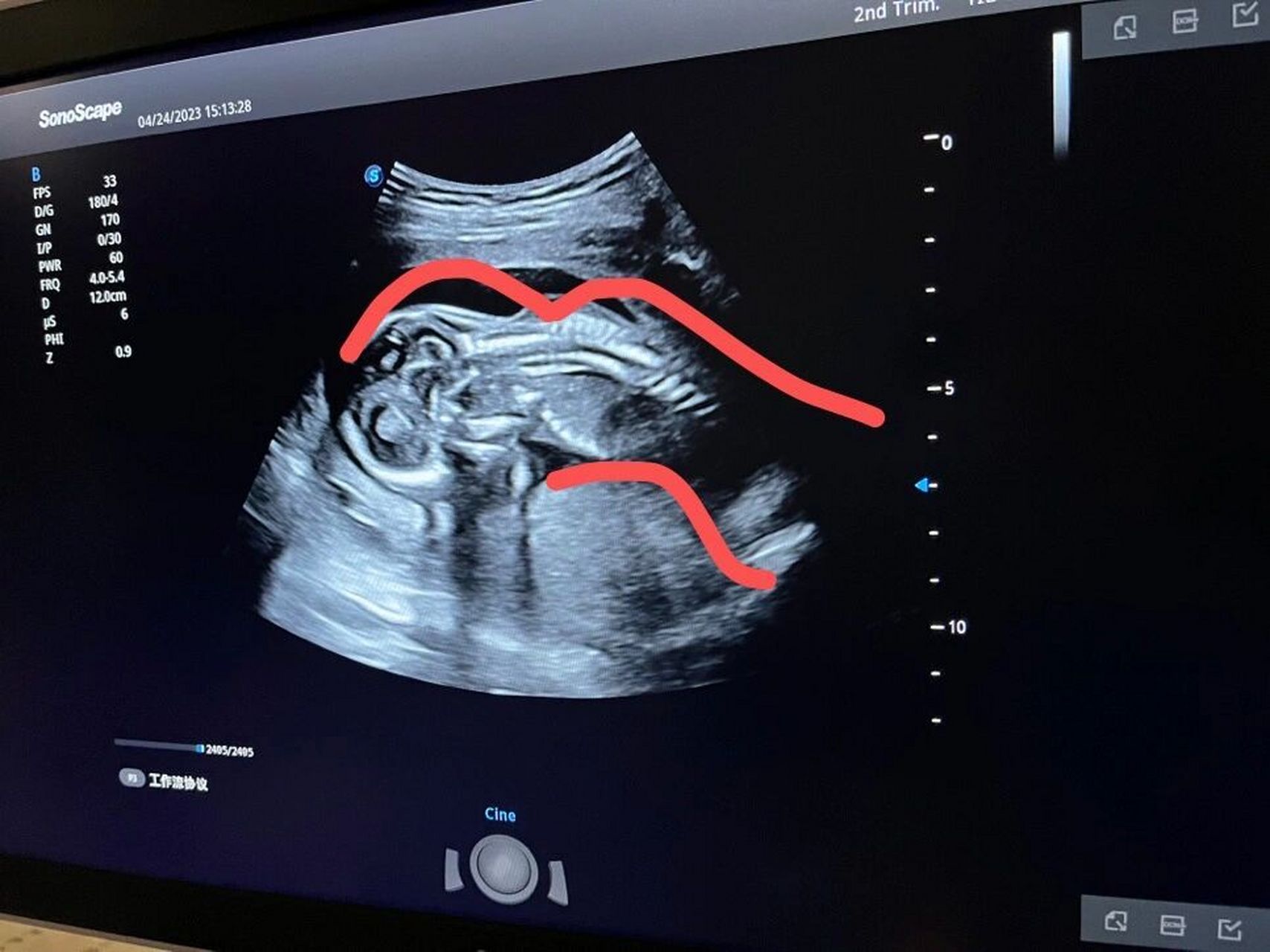 孕17周我的娃一直趴着 我的娃娃,你趴着在干嘛呀,对你很好奇,你竟然