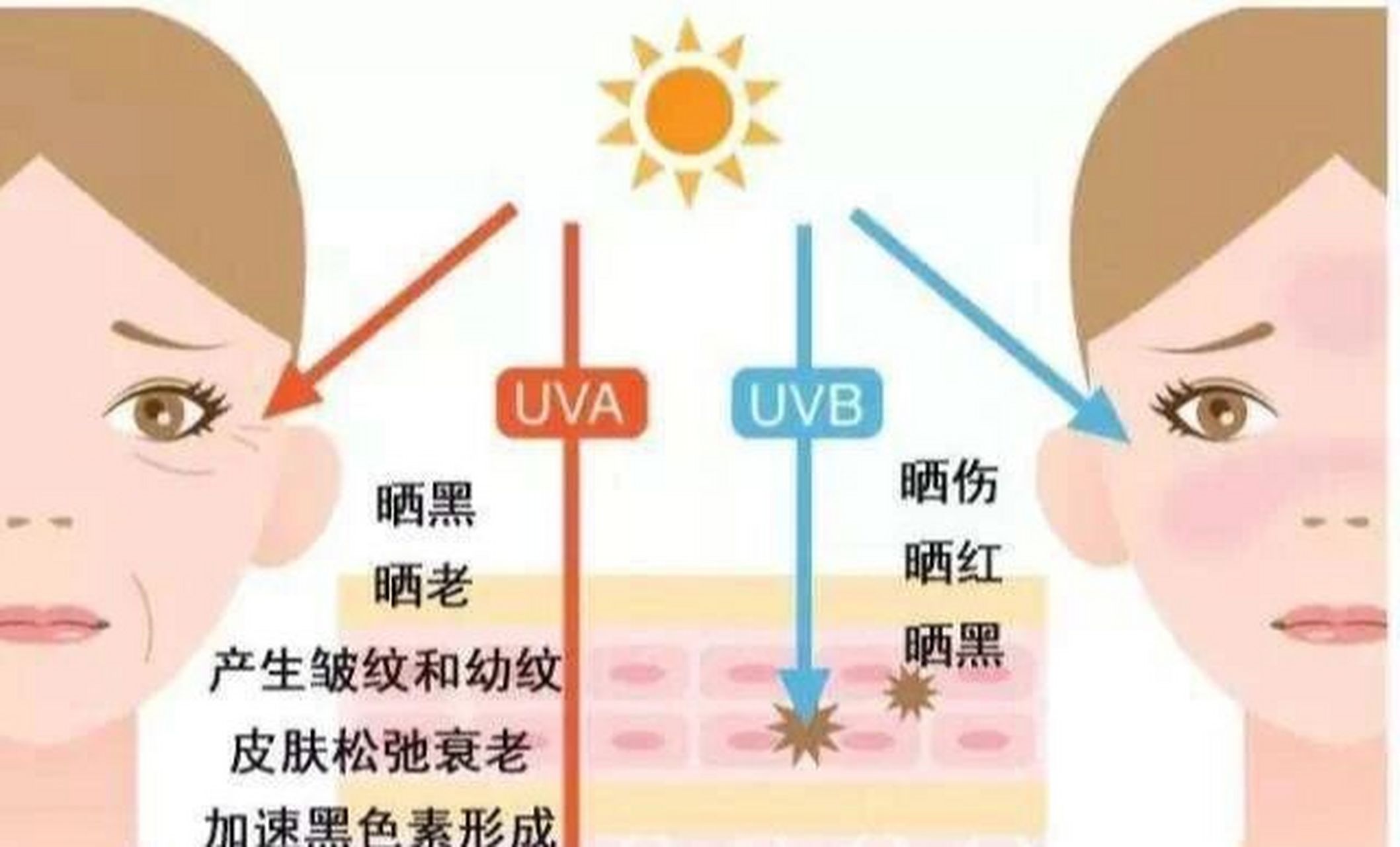 中波,短波长波(uva):能穿透玻璃 ,对皮肤的穿透能力比较强,可以深达