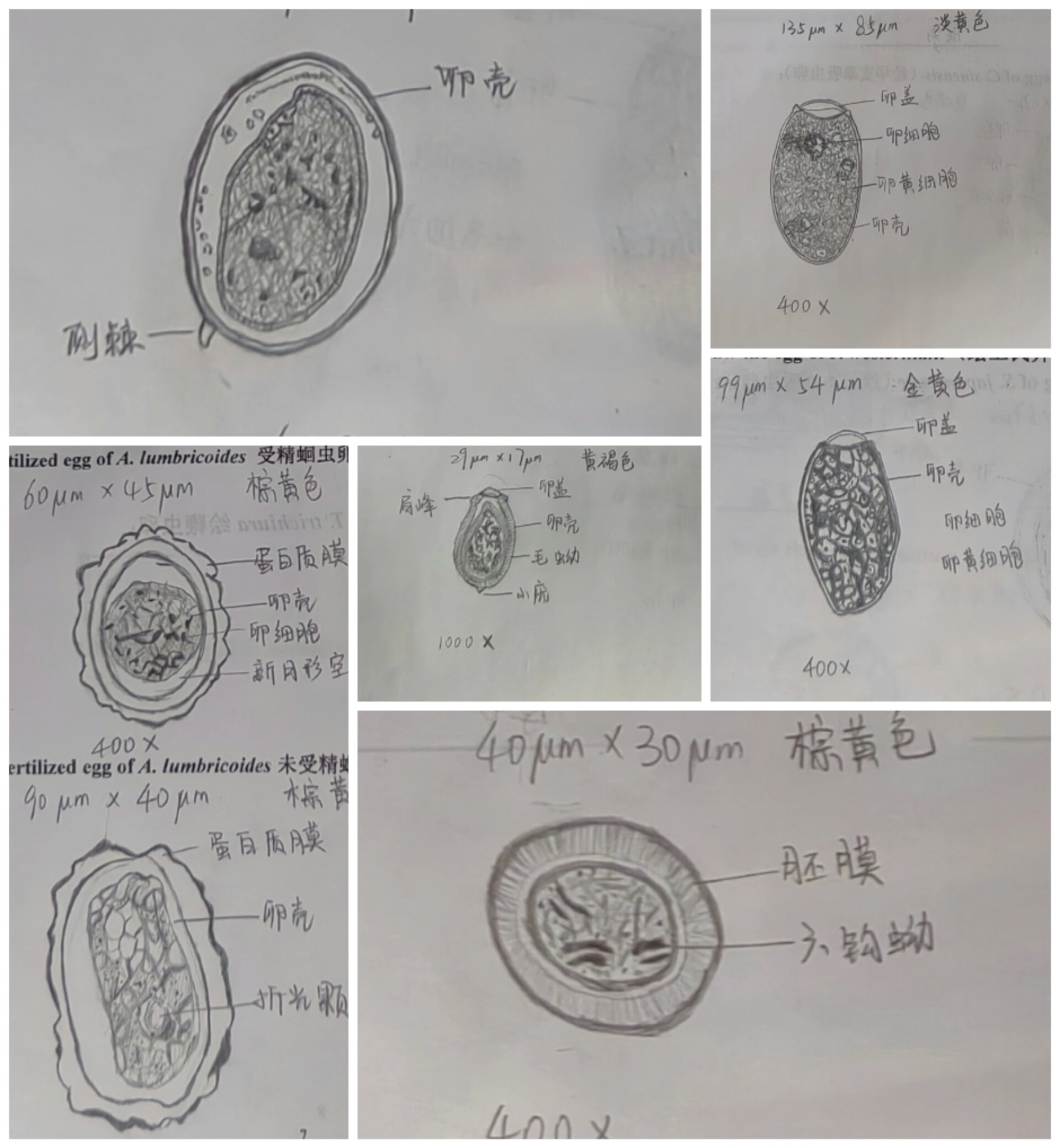 卫氏并殖吸虫手绘图图片