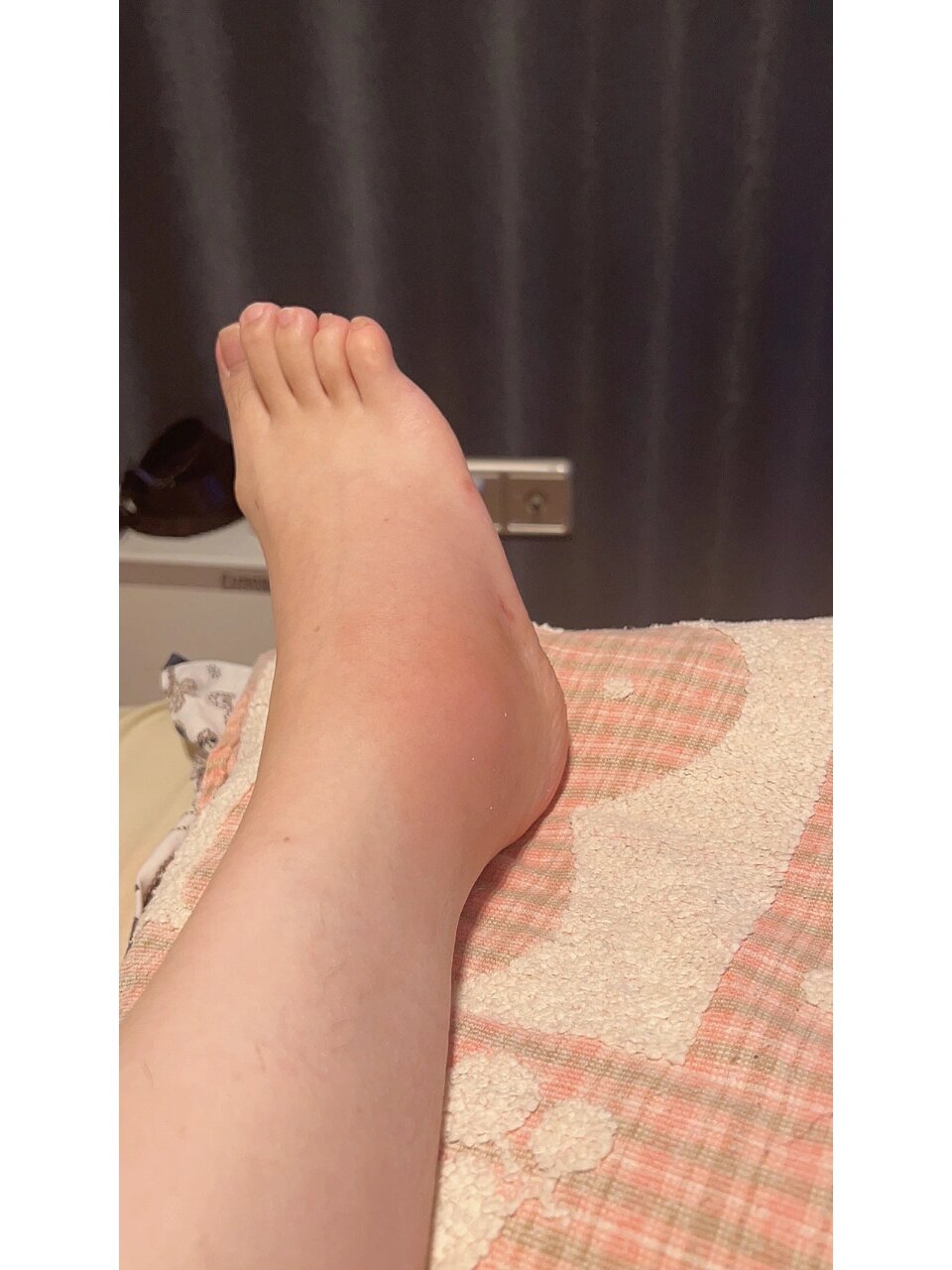 崴脚后去医院的流程及注意事项⚠️ 上一篇说了崴脚之后最重要的