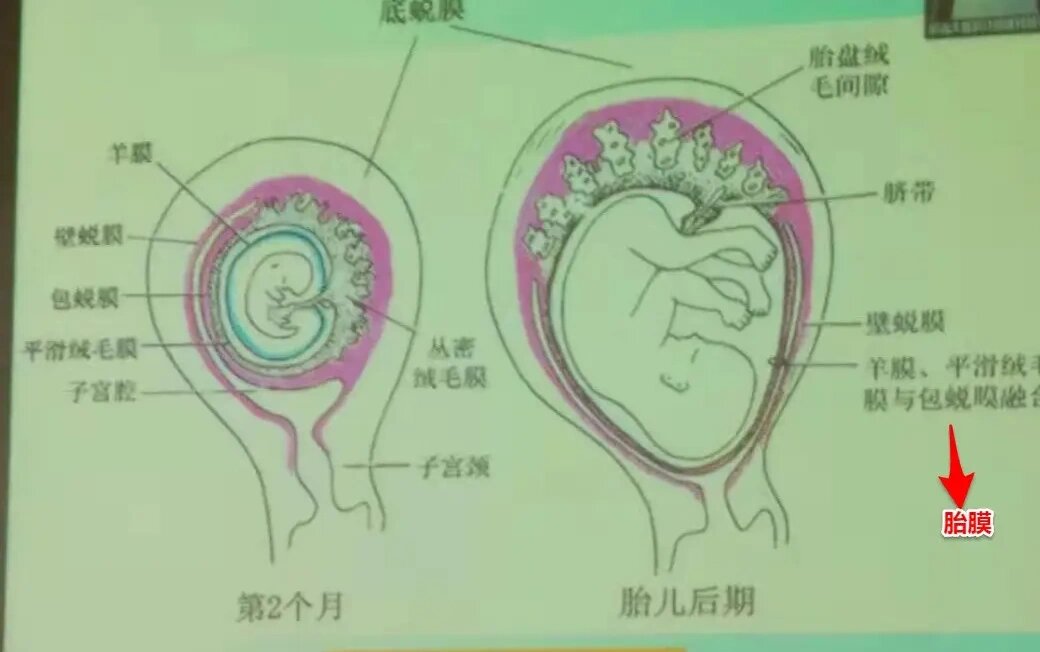 受精卵四面八方的墙就是蜕膜(底,包,壁)包蜕膜后期和绒毛膜融合了 有