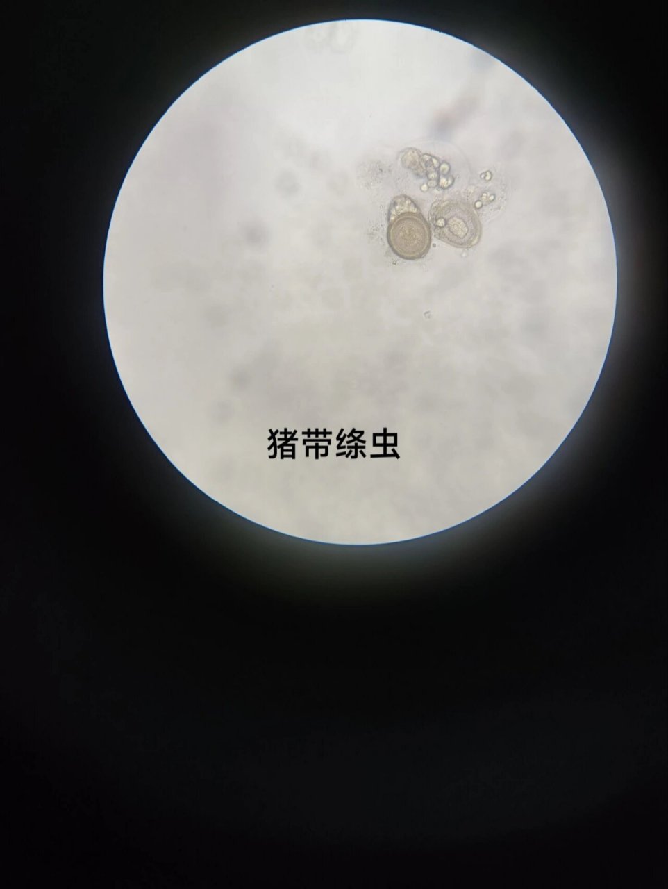 医学蠕虫显微镜观察(五) 医学蠕虫    绦虫纲 链状带绦虫又称猪肉绦虫