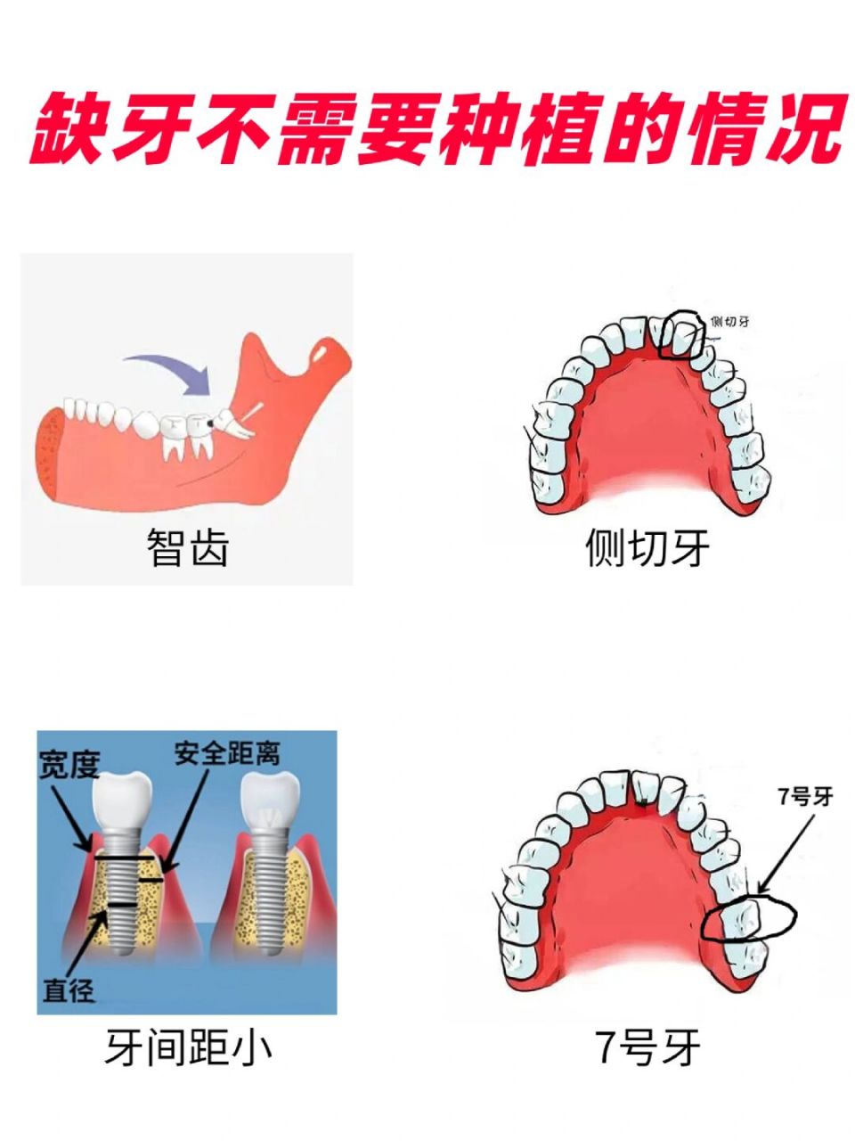 牙齿的种类有哪些图片