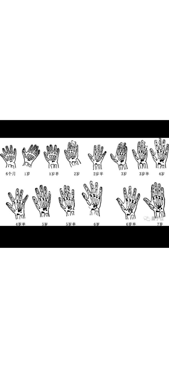 儿童骨龄图谱手腕图片
