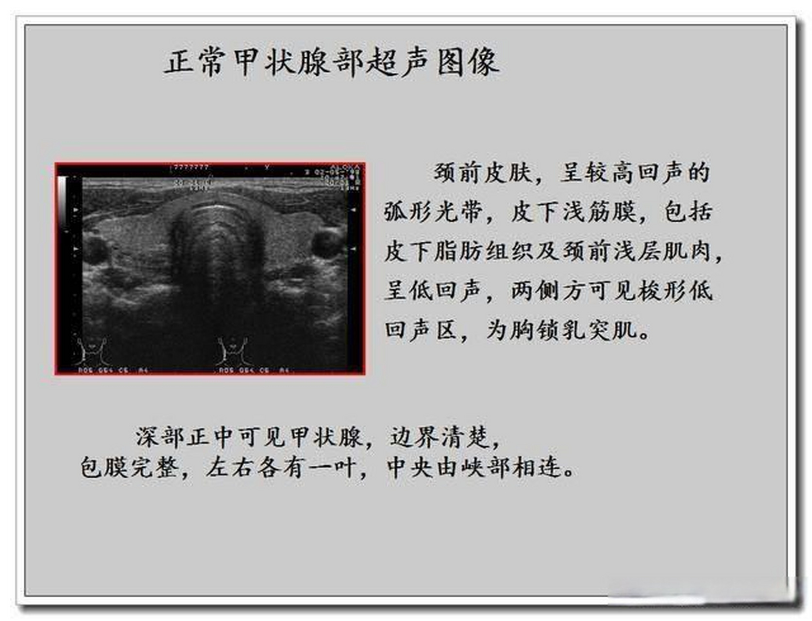 甲状腺彩超中的"回声"是什么意思?