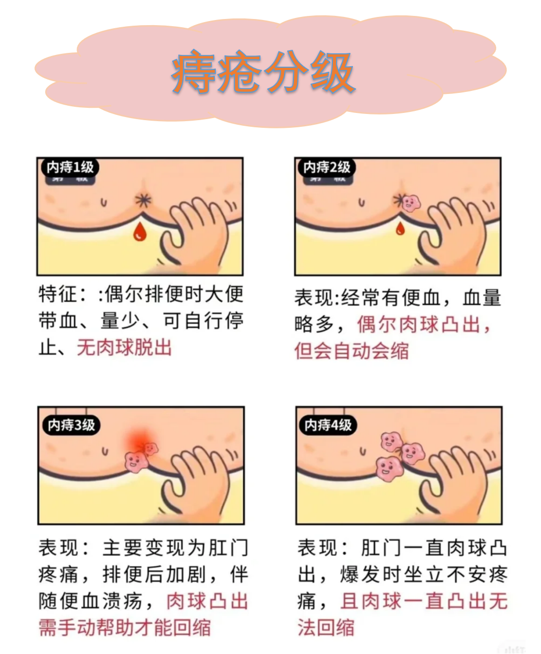 什么样的外痔疮肉球突出图片大肛门口有个肉球突出不疼不痒是怎么回事