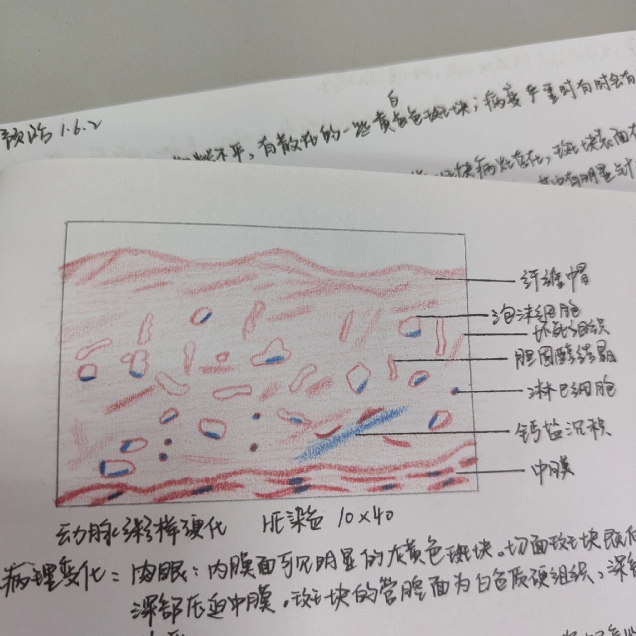 动脉粥样硬化红蓝铅笔图片