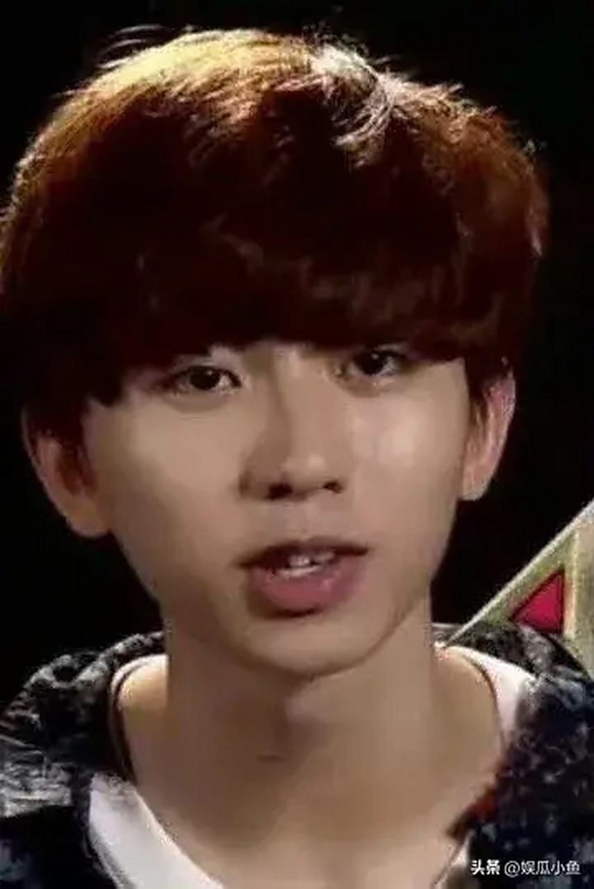 蔡徐坤整容这件事已经不是什么新瓜了吧,但是他塌房前粉丝都说他没do